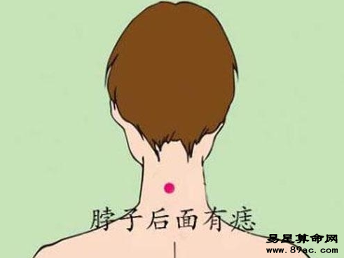 男人脖子上有痣圖解,女人脖子上有痣圖解