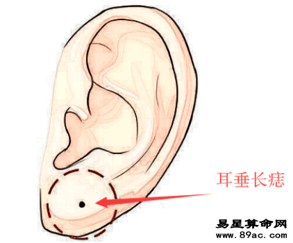 旺財痣, 身上此處長善痣, 發橫財, 進偏財, 看你臉上得是不是