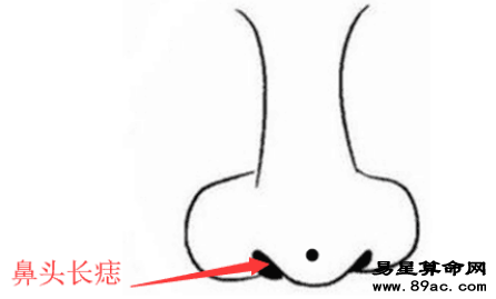 旺財痣, 身上此處長善痣, 發橫財, 進偏財, 看你臉上得是不是